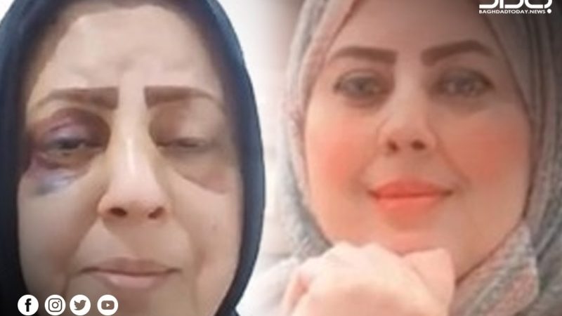 أين الحقيقة؟.. القصة الكاملة لامرأة “شُوهت ملامحها” بعد خروجها من مركز للشرطة ببغداد